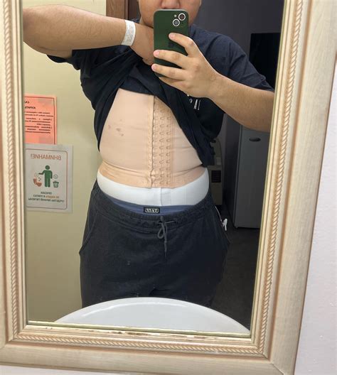 The Recovery Bubble: Navigating the First Few Days Post-Op