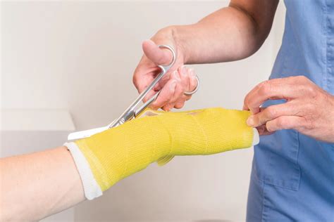 Wishes for When the Cast Comes Off