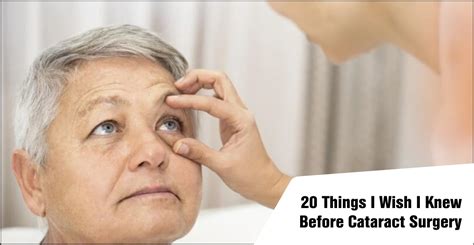 Seeing Clearly: 50 Things I Wish I Knew Before Cataract Surgery